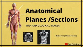 Anatomical Planes Sections and its Importance in Radiology Department [upl. by Odnalor]