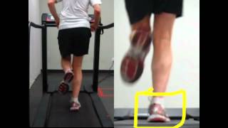 Running  RunSmart  Controlling Pronation From Your Hips [upl. by Olbap]