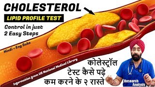 Cholesterol Kam Kaise Kare  Cholesterol Control  How to control cholesterol  The Health Show [upl. by Mackey]