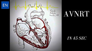 Atrioventricular Nodal Reentry Tachycardia AVNRT Animation and ECG Shorts [upl. by Stuart]