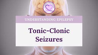 What are TonicClonic Seizures [upl. by Acira]