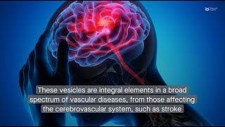 Decoding the roles of extracellular vesicles in vascular diseases [upl. by Uhayile]