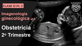 122  Imagen en Obstetricia 2o Trimestre [upl. by Kcirdot]