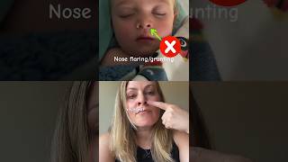 What does CROUP sound like amp Home Treatment for Croup [upl. by Uchish]