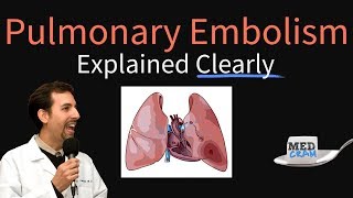 Pulmonary Embolism Explained Clearly  Risk factors Pathophysiology DVT Treatment [upl. by Jalbert]