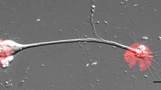 Cytoskeletal Mechanisms of Axonal Contractility [upl. by Redan610]