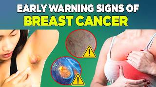 Spot It While Breast Cancer is STILL Curable 10 Warning Signs [upl. by Margit]