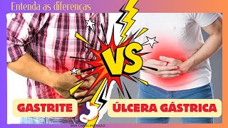 Gastrite X Úlcera Gástrica Entenda as Diferenças [upl. by Florrie]