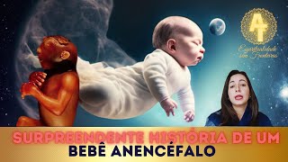 Surpreendente História REAL de um Bebê Anencéfalo [upl. by Levitus]