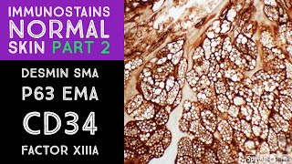 Immunohistochemistry in Normal Skin p63 EMA desmin SMA CD34 Factor XIIIa [upl. by Clifton]