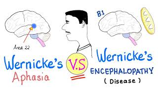 Wernicke’s Aphasia vs Wernickes Encephalopathy  Neurology [upl. by Ssecnirp]