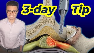 Physical Therapy after Lumbar Laminectomy 03 Day Secrets for Success [upl. by Polash122]