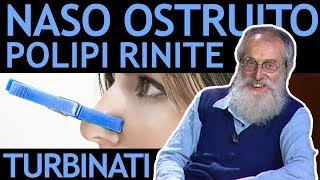 Dott Mozzi Naso ostruito polipi nasali turbinati rinite sinusite [upl. by Suoinuj771]