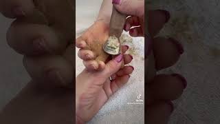 Removing callus from kid hands  Keratoderma hyperkeratosis EPPK skin shaving callous  Apr 2 2023 [upl. by Tonneson964]