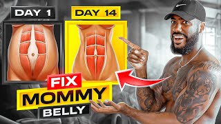 FIX MOMMY BELLY  2 WEEKS DO THIS EVERYDAY [upl. by Ahsha]