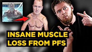 PHYSIQUE DESTROYED INSANE Muscle ATROPHY by PostFinasteride Syndrome  Ryan Clarks 20 Years of PFS [upl. by Htir729]