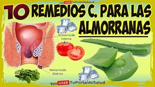 Eliminar Las Hemorroides 10 Remedios Caseros Para Curar Las Almorranas [upl. by Anaej]