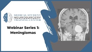 Webinar Series 1 Meningiomas [upl. by Kihtrak702]