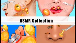 ASMR Collection  Sebum Dirty Nose Piercing Calluses Ingrown Hairs Removal Animation [upl. by Attekram]