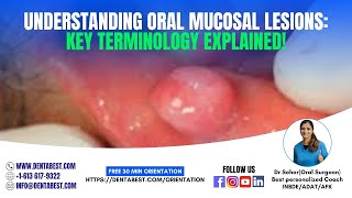 TERMINOLOGYORAL MUCOSAL LESIONS [upl. by Stark630]