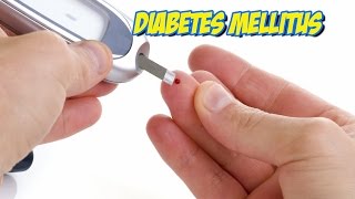 Diabetes Mellitus [upl. by Garvey]