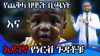 የጨቅላ ህፃናት ቢጫነት ካልታከመ የሚያመጣቸው የነርቭ ጉዳቶች  Neonatal Jaundice complications  DrFasil  ብሩህkids [upl. by Edda161]