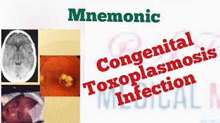 Congenital toxoplasmosis Triad Mnemonic [upl. by Dibb]