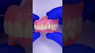 Look at these prostheses Upper acrylic and lower flexible mrdent dentist smile protesisdental [upl. by Llener]