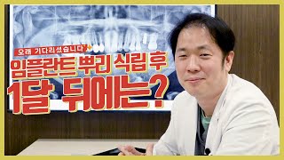 Drlength 임플란트 수술후 1달체크 확실한 검진으로 오래 유지할 수 있도록 도와드리겠습니다 [upl. by Fugazy]