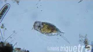 Euchlanis triquetra Zooplankton Rotifer [upl. by Gabel]