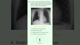 Radiology Buzz 22 radiologychannel007 [upl. by Orimisac763]