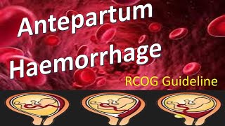 Antepartum Haemorrhage  RCOG Guideline [upl. by Llebiram]