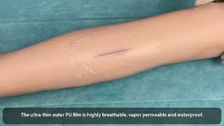 WOUND FREE Hydrogel Wound Dressings [upl. by Eveneg]