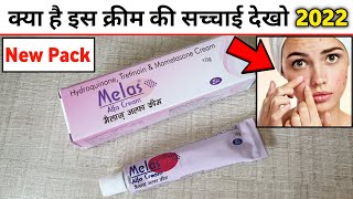 Melas Alfa Cream Review 2021  How to use Melas Alfa Cream in hindi [upl. by Guglielma]