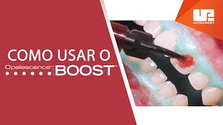 Passo a passo de como usar o clareador Opalescence ™ Boost ™ [upl. by Noma]