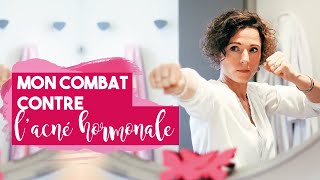 Mon PARCOURS MÉDICAL Contre LACNÉ HORMONALE Et Comment Je Men Suis Sortie [upl. by Dimah]