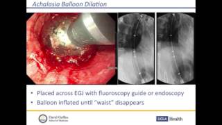 Achalasia – Treatment Options  Jeffrey L Conklin MD  UCLA Digestive Disease [upl. by Angadreme127]