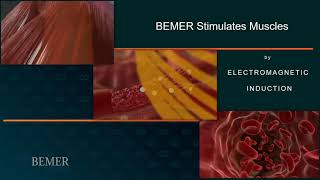 BEMER  A Look Inside our Microvascular System [upl. by Rosena]