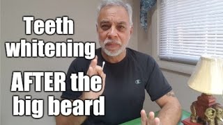 Teeth Whitening AFTER the big beard [upl. by Roselyn]