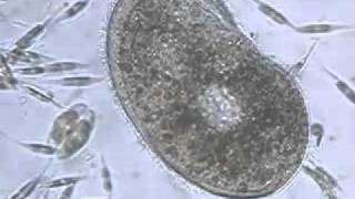 Ciliate Phylum of Protozoa [upl. by Zoller]