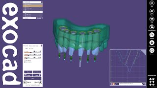 exocad Video Tutorial Model Creator [upl. by Aleris]