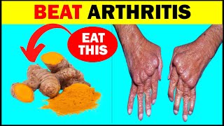 10 Foods That Will Reduce Pain And Inflammation From Arthritis [upl. by Rednave]