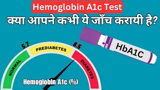 HBA1C test kya hota hai  HbA1c test in hindi  HbA1c test normal range  Hemoglobin A1c test [upl. by Bennet786]