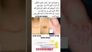 contractubex gelfor face amp skinbest foracne scarburn markinjury markstitches Markpimples💝💝💝 [upl. by Allimac]