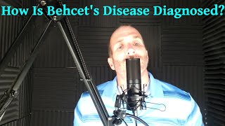 How Is Behcets Disease Diagnosed [upl. by Reuben376]