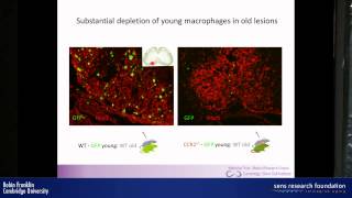 Myelin regeneration and ageing  Robin Franklin [upl. by Lacagnia]