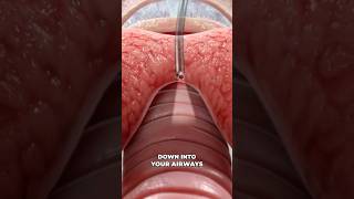 Bronchoscopy 3D Animation [upl. by Sinnel]