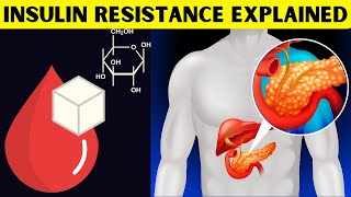 Insulin Resistance Explained What Is Insulin Resistance amp How It Leads To Type II Diabetes [upl. by Chamkis406]