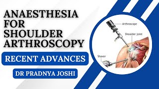 Recent Advances in Anaesthesia for Shoulder Surgery I Dr Pradnya Joshi [upl. by Casimire804]