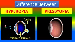 Difference between Hyperopia and Presbyopia [upl. by Clerissa]